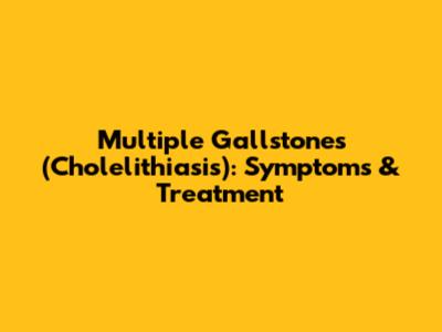 Multiple Gallstones (Cholelithiasis): Symptoms & Treatment